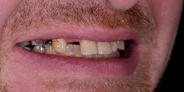 Bundoora Denture Dentistry
