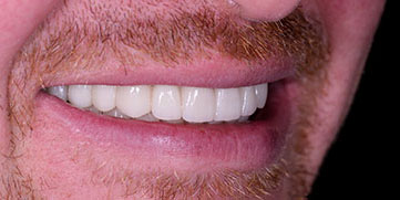 Bundoora Denture Dentistry