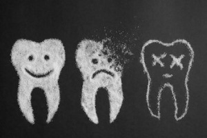 tooth diagnosis bundoora