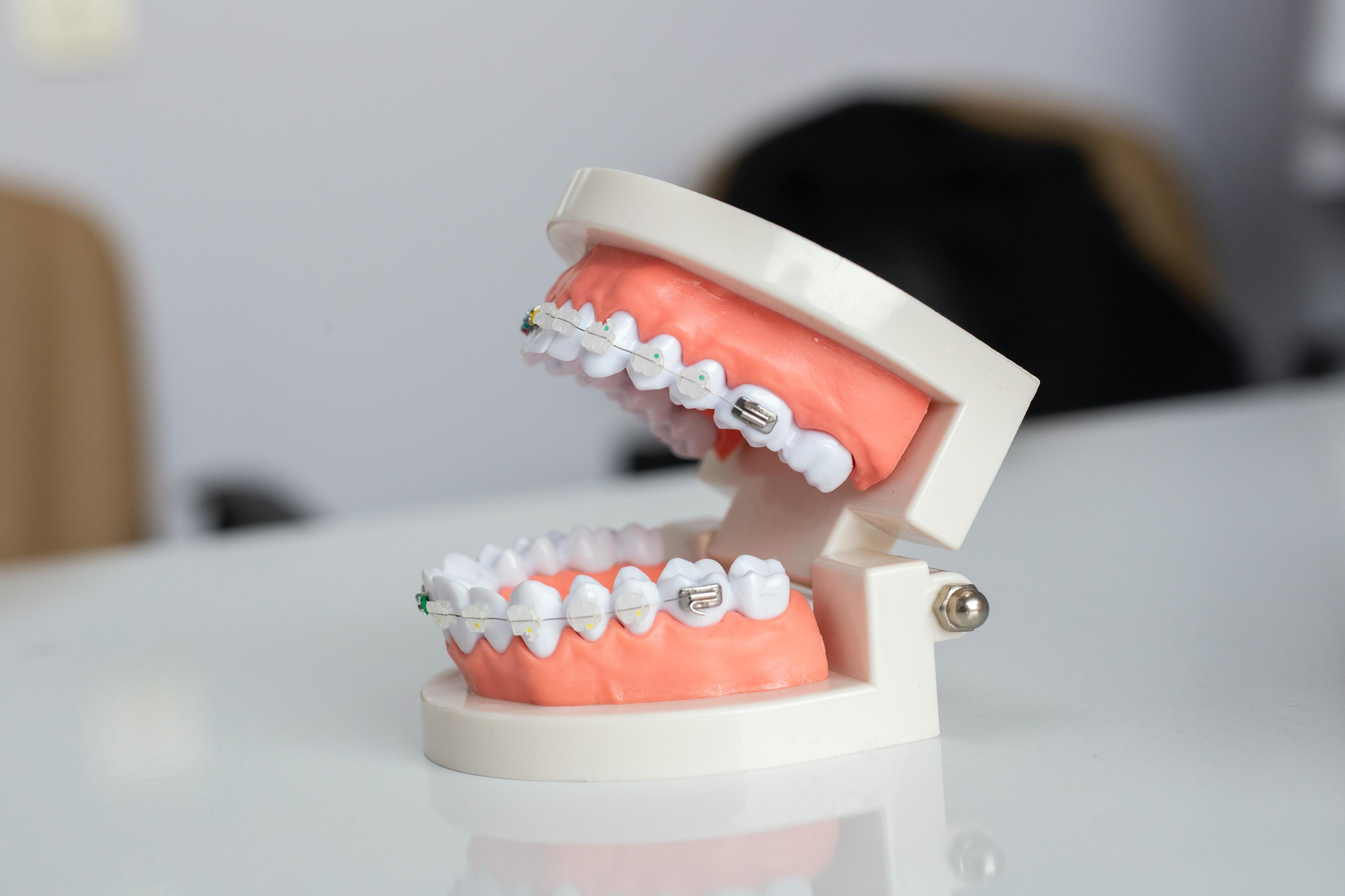 The Evolution of Braces: A Journey to Straighter Smiles